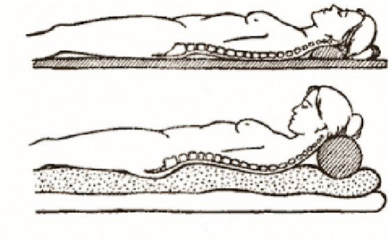 Figura da osteocondrose